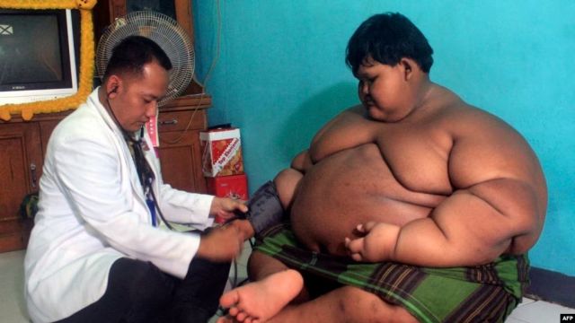 Indonesia Bergulat Dengan Masalah Obesitas